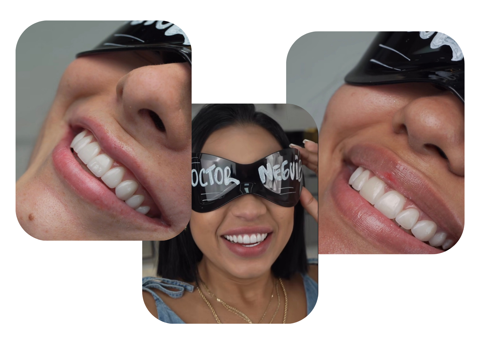 Diseño de sonrisas Dr. Neguib